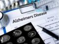 Diagnosis of Alzheimer's, dementia decreases social activity: Study - Hindi News | Diagnosis of Alzheimer's, dementia decreases social activity: Study | Latest health News at Lokmattimes.com