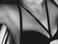 How you can remove underarm pigmentation - Hindi News | How you can remove underarm pigmentation | Latest lifestyle News at Lokmattimes.com