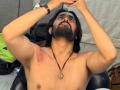 Bhuvan Bam gets injured while shooting for 'Taaza Khabar' - Hindi News | Bhuvan Bam gets injured while shooting for 'Taaza Khabar' | Latest entertainment News at Lokmattimes.com