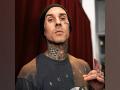 Travis Barker undergoes hand surgery - Hindi News | Travis Barker undergoes hand surgery | Latest entertainment News at Lokmattimes.com