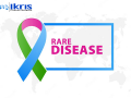 Do rare Diseases account for the economic burden on India? - Hindi News | Do rare Diseases account for the economic burden on India? | Latest business News at Lokmattimes.com
