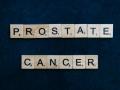 Researchers reveal connection of healthy diet, prostate cancer - Hindi News | Researchers reveal connection of healthy diet, prostate cancer | Latest lifestyle News at Lokmattimes.com