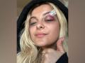 Bebe Rexha rushed off stage after being hit in head with phone by fan - Hindi News | Bebe Rexha rushed off stage after being hit in head with phone by fan | Latest entertainment News at Lokmattimes.com