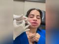 Uorfi Javed shares video of her getting lip fillers dissolved - Hindi News | Uorfi Javed shares video of her getting lip fillers dissolved | Latest entertainment News at Lokmattimes.com