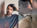 Anuj Sachdeva alleges "no arrest" in attack incident, shares visible injury marks - Hindi News | Anuj Sachdeva alleges "no arrest" in attack incident, shares visible injury marks | Latest entertainment News at Lokmattimes.com