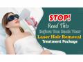Thinking of Laser Hair Removal? Read This Before You Book Your Treatment Package - Hindi News | Thinking of Laser Hair Removal? Read This Before You Book Your Treatment Package | Latest business News at Lokmattimes.com