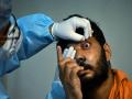 Researchers urge for microbiology-guided diagnosis following discovery of drug-resistant eye pathogens - Hindi News | Researchers urge for microbiology-guided diagnosis following discovery of drug-resistant eye pathogens | Latest national News at Lokmattimes.com