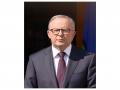 Australia to build USD 7.22 billion fuel reserve to "shield" nation from global supply shocks - Hindi News | Australia to build USD 7.22 billion fuel reserve to "shield" nation from global supply shocks | Latest international News at Lokmattimes.com