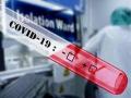 Karnataka reports 4,764 new COVID-19 cases, 55 deaths in last 24 hours - Hindi News | Karnataka reports 4,764 new COVID-19 cases, 55 deaths in last 24 hours | Latest national News at Lokmattimes.com