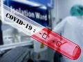 8 more COVID-19 cases in Karnataka, state tally reaches 659 - Hindi News | 8 more COVID-19 cases in Karnataka, state tally reaches 659 | Latest national News at Lokmattimes.com