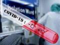 3 more COVID-19 cases in Manipur, state tally reaches 32 - Hindi News | 3 more COVID-19 cases in Manipur, state tally reaches 32 | Latest national News at Lokmattimes.com
