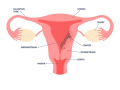 Why gynaecological cancers are rising among young Indian women - Hindi News | Why gynaecological cancers are rising among young Indian women | Latest health News at Lokmattimes.com