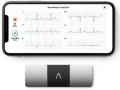 AliveCor brings the world's only six-lead, FDA-cleared personal ECG to India - Hindi News | AliveCor brings the world's only six-lead, FDA-cleared personal ECG to India | Latest business News at Lokmattimes.com