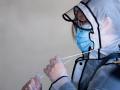 Proper disposal of used masks important to fight coronavirus: Pulmonologist Arun Prasad - Hindi News | Proper disposal of used masks important to fight coronavirus: Pulmonologist Arun Prasad | Latest national News at Lokmattimes.com