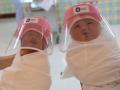 Thailand hospitals come up with mini face shields to protect newborns from coronavirus - Hindi News | Thailand hospitals come up with mini face shields to protect newborns from coronavirus | Latest international News at Lokmattimes.com