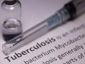 Research: Treatment length for children with tuberculosis now reduced - Hindi News | Research: Treatment length for children with tuberculosis now reduced | Latest health News at Lokmattimes.com
