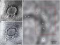 Indian scientists reveal microscopic image of novel coronavirus - Hindi News | Indian scientists reveal microscopic image of novel coronavirus | Latest national News at Lokmattimes.com