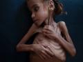 Madagascar reports 'pockets of famine', risks grow for children: WFP - Hindi News | Madagascar reports 'pockets of famine', risks grow for children: WFP | Latest international News at Lokmattimes.com