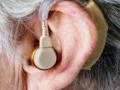 Hearing aids may help in fight against dementia: Lancet - Hindi News | Hearing aids may help in fight against dementia: Lancet | Latest technology News at Lokmattimes.com