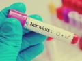 Scientists find norovirus, other gut viruses can spread through saliva - Hindi News | Scientists find norovirus, other gut viruses can spread through saliva | Latest international News at Lokmattimes.com