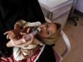 Yemen heading toward biggest famine in modern history - Hindi News | Yemen heading toward biggest famine in modern history | Latest international News at Lokmattimes.com