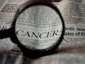 Cancer patients undergoing treatment are more susceptible to COVID-19 misinformation: Study - Hindi News | Cancer patients undergoing treatment are more susceptible to COVID-19 misinformation: Study | Latest health News at Lokmattimes.com