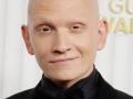 'Superman Legacy': Anthony Carrigan wanted to play Metamorpho before he even got the role - Hindi News | 'Superman Legacy': Anthony Carrigan wanted to play Metamorpho before he even got the role | Latest international News at Lokmattimes.com