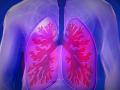 Lung function seems to be unaffected post COVID-19 infection in young adults - Hindi News | Lung function seems to be unaffected post COVID-19 infection in young adults | Latest health News at Lokmattimes.com