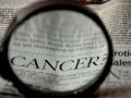 Head & neck cancer cases on rise in Bengaluru: Experts - Hindi News | Head & neck cancer cases on rise in Bengaluru: Experts | Latest health News at Lokmattimes.com