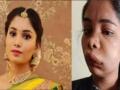 Kannada actress Swathi's face swollen after root canal surgery - Hindi News | Kannada actress Swathi's face swollen after root canal surgery | Latest entertainment News at Lokmattimes.com