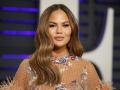 Chrissy Teigen says 'lip about to explode' due to altitude sickness - Hindi News | Chrissy Teigen says 'lip about to explode' due to altitude sickness | Latest entertainment News at Lokmattimes.com