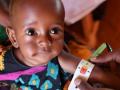 South Sudan declares measles outbreak - Hindi News | South Sudan declares measles outbreak | Latest health News at Lokmattimes.com