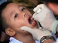 WHO, Unicef declare end of polio outbreak in Philippines - Hindi News | WHO, Unicef declare end of polio outbreak in Philippines | Latest international News at Lokmattimes.com