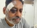 Pushed by cops, Maha Congress' Dr. Nitin Raut hurt in Bharat Jodo Yatra - Hindi News | Pushed by cops, Maha Congress' Dr. Nitin Raut hurt in Bharat Jodo Yatra | Latest maharashtra News at Lokmattimes.com