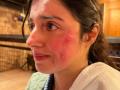 Divya Khosla Kumar gets injured while shooting for her upcoming project - Hindi News | Divya Khosla Kumar gets injured while shooting for her upcoming project | Latest entertainment News at Lokmattimes.com