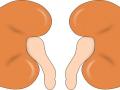 Hyderabad woman saves son by donating kidney - Hindi News | Hyderabad woman saves son by donating kidney | Latest national News at Lokmattimes.com