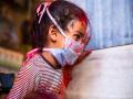 Researchers say children falling ill with mysterious inflammatory syndrome probably linked to COVID-19 - Hindi News | Researchers say children falling ill with mysterious inflammatory syndrome probably linked to COVID-19 | Latest international News at Lokmattimes.com