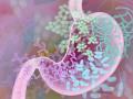 Microbiome discovery may aid treatments for gastrointestinal diseases: Study - Hindi News | Microbiome discovery may aid treatments for gastrointestinal diseases: Study | Latest health News at Lokmattimes.com