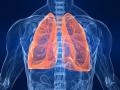 Molecules in vegetables like cauliflower can help to ease lung infection: Study - Hindi News | Molecules in vegetables like cauliflower can help to ease lung infection: Study | Latest international News at Lokmattimes.com