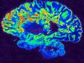 Researchers find a lot of brain real estate taken up when disagreeing - Hindi News | Researchers find a lot of brain real estate taken up when disagreeing | Latest technology News at Lokmattimes.com