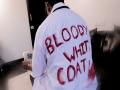 'Bloody White Coat' song raises awareness on abuse of healthcare frontline workers - Hindi News | 'Bloody White Coat' song raises awareness on abuse of healthcare frontline workers | Latest entertainment News at Lokmattimes.com