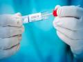 Woman in UP's Mathura tests positive for South African strain of coronavirus - Hindi News | Woman in UP's Mathura tests positive for South African strain of coronavirus | Latest national News at Lokmattimes.com