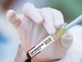 How Singapore, India are contributing to a COVID-19 vaccine race - Hindi News | How Singapore, India are contributing to a COVID-19 vaccine race | Latest international News at Lokmattimes.com