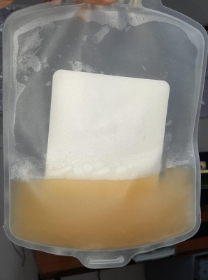 Engineer arrested for attacking elderly man on suspicion of witchcraft | जादू टोने के संदेह पर बुजुर्ग पर हमला करने के आरोप में इंजीनियर गिरफ्तार