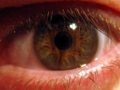 Delhi sees record rise in pink eye, dengue cases, say doctors | Delhi sees record rise in pink eye, dengue cases, say doctors Delhi sees record rise in pink eye, dengue cases, say doctors | Delhi sees record rise in pink eye, dengue cases, say doctors
