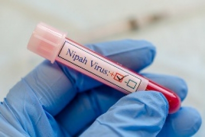 Kerala woman tests positive for Nipah | Kerala woman tests positive for Nipah Kerala woman tests positive for Nipah | Kerala woman tests positive for Nipah