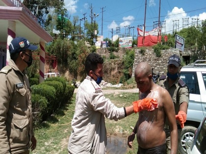 Uttarakhand: Mentally ill man receives assistance from cops amid COVID-19 lockdown in Pithoragarh | Uttarakhand: Mentally ill man receives assistance from cops amid COVID-19 lockdown in Pithoragarh