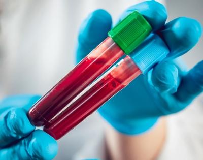 New test can detect Alzheimer's neurodegeneration in blood | New test can detect Alzheimer's neurodegeneration in blood