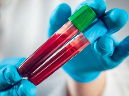 New blood test may detect ovarian cancer early with 91% accuracy | New blood test may detect ovarian cancer early with 91% accuracy New blood test may detect ovarian cancer early with 91% accuracy | New blood test may detect ovarian cancer early with 91% accuracy