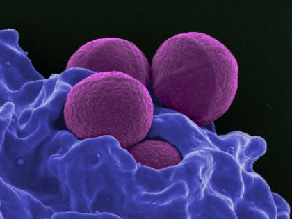 New class of antibiotics to fight off drug-resistant bacteria | New class of antibiotics to fight off drug-resistant bacteria